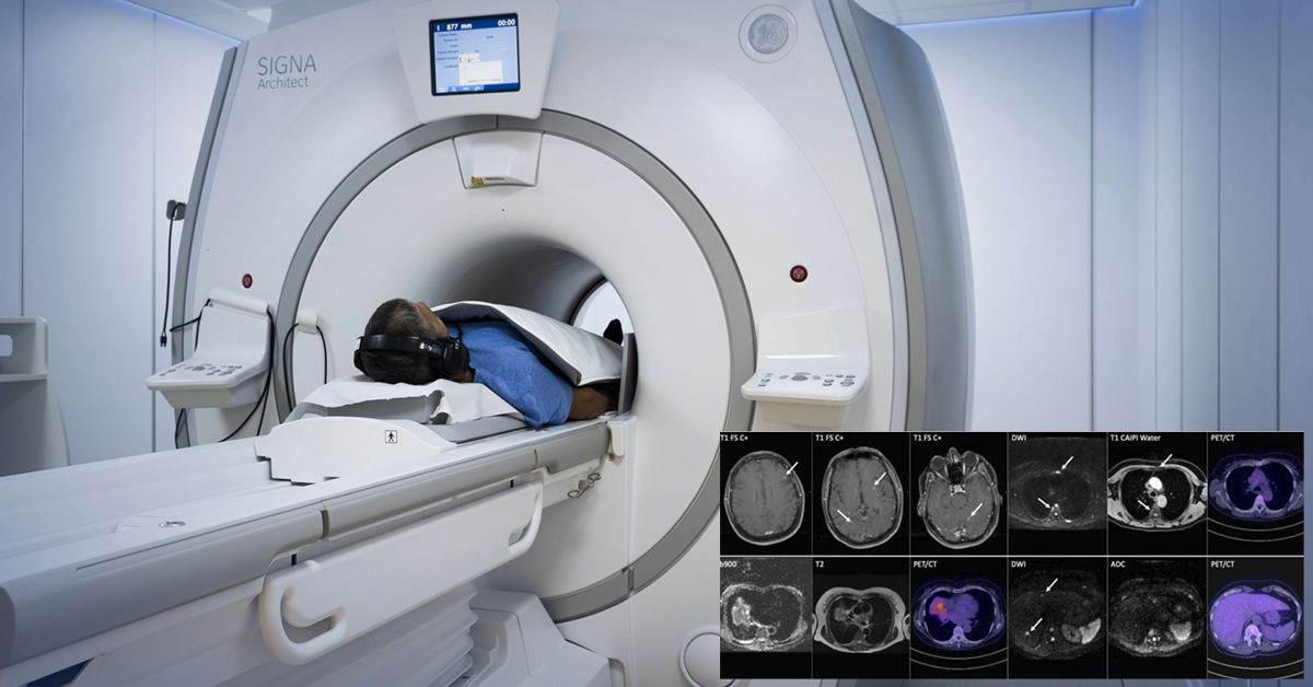 Mri Teljes Test Copy