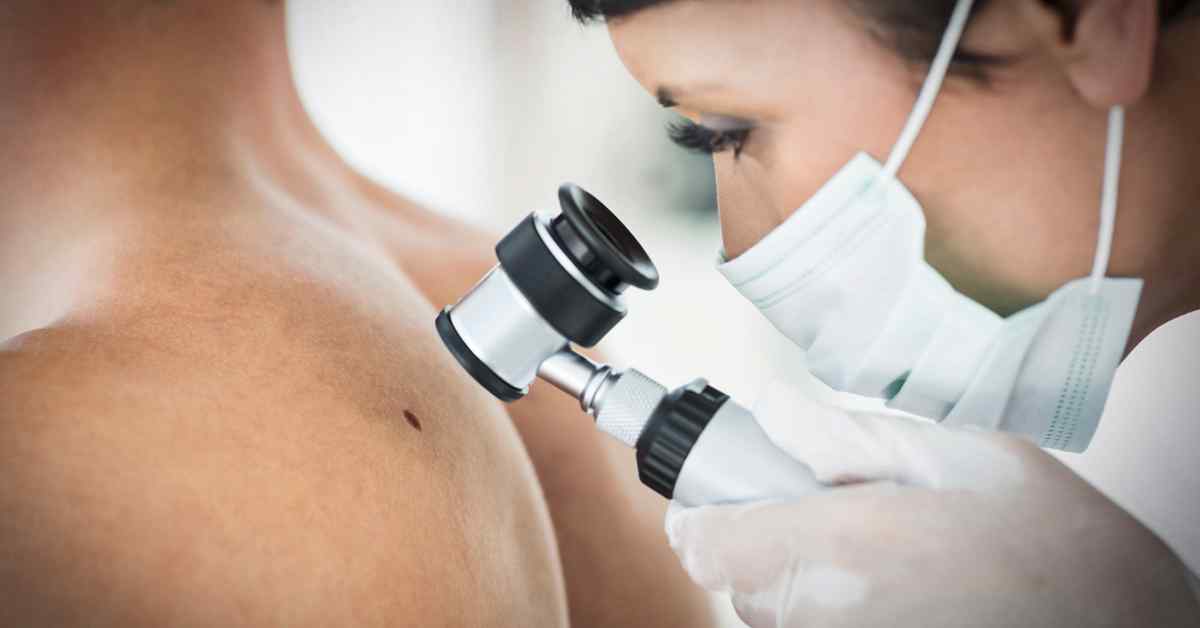 Melanoma Poszt Copy