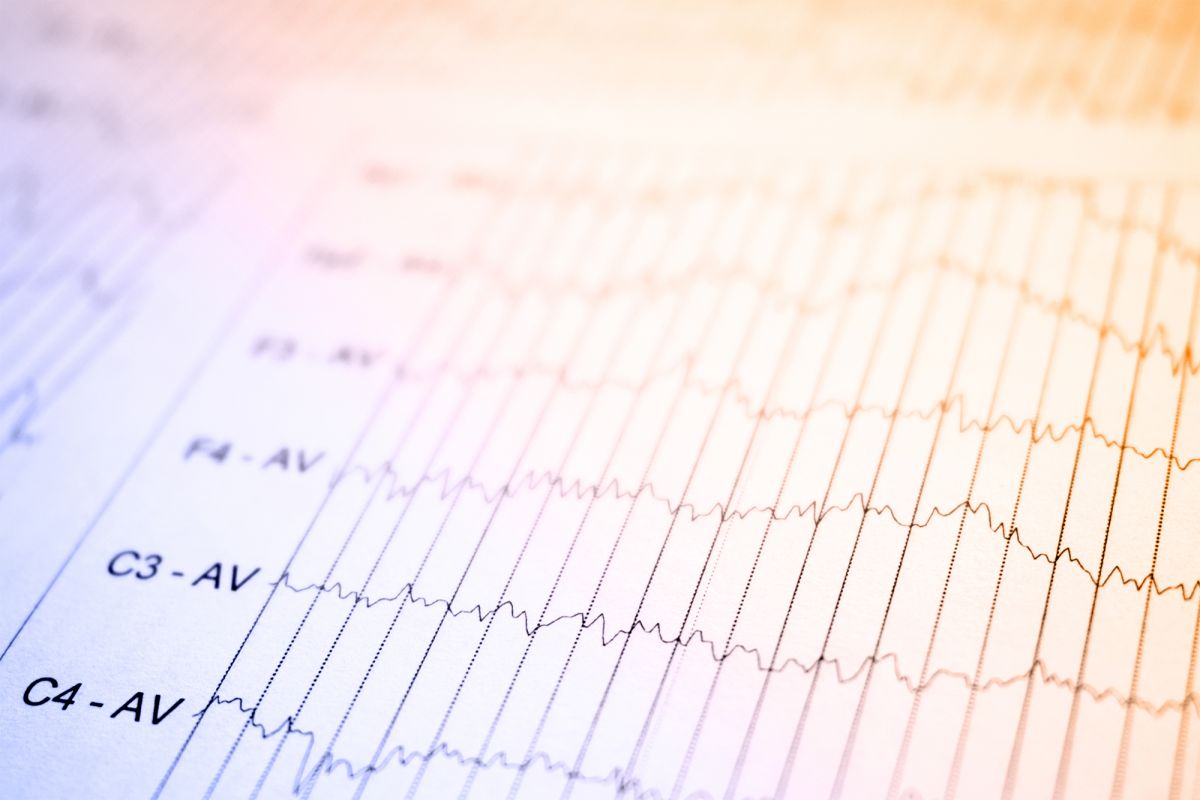 Eeg